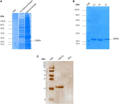 Entry Inhibition and Modulation of Pro-Inflammatory Immune Response Against Influenza A Virus by a Recombinant Truncated Surfactant Protein D